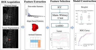 Radiomics signatures for predicting the Ki-67 level and HER-2 status based on bone metastasis from primary breast cancer